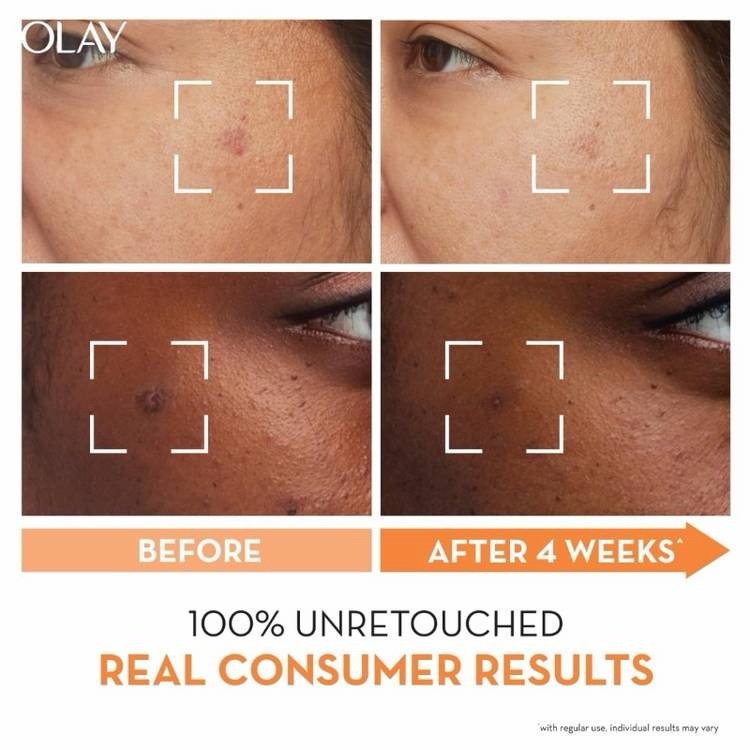 Olay Luminous Niacinamide + Vitamin C Moisturiser SPF 30 - 50g