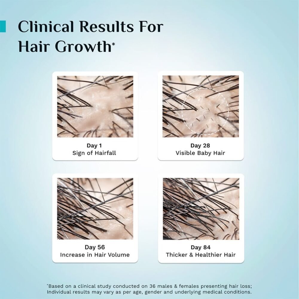 Pilgrim Advanced Hair Growth Serum with Korean Black Rice - 50ml