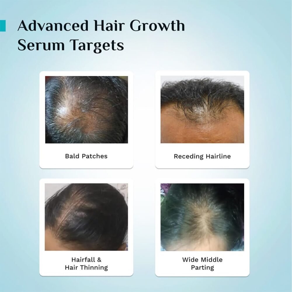 Pilgrim Advanced Hair Growth Serum with Korean Black Rice - 50ml
