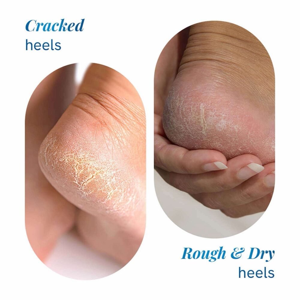 Be Bodywise 20% Urea Foot Roll On - 50ml