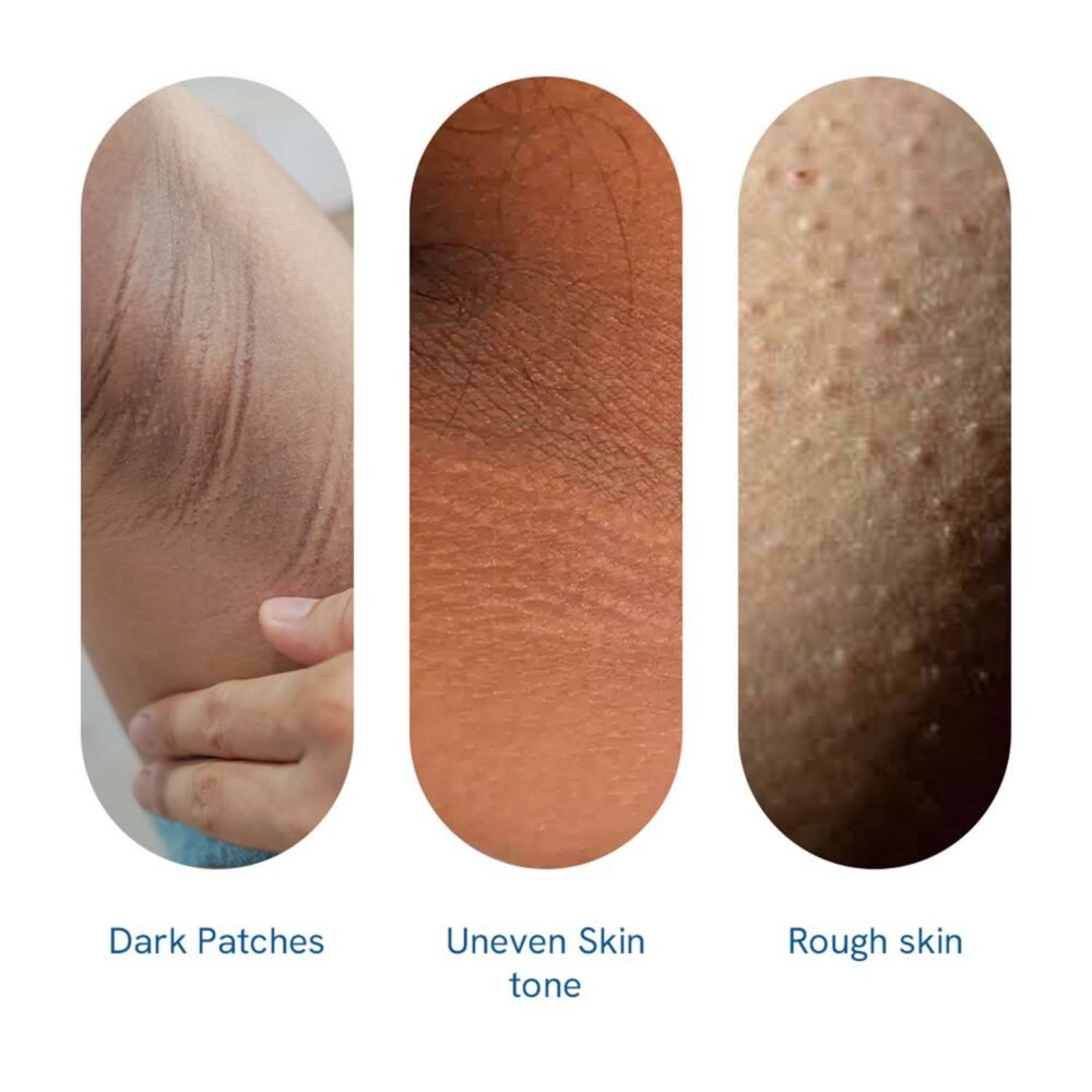 Be Bodywise Pigmentation Repair Cream - 100g
